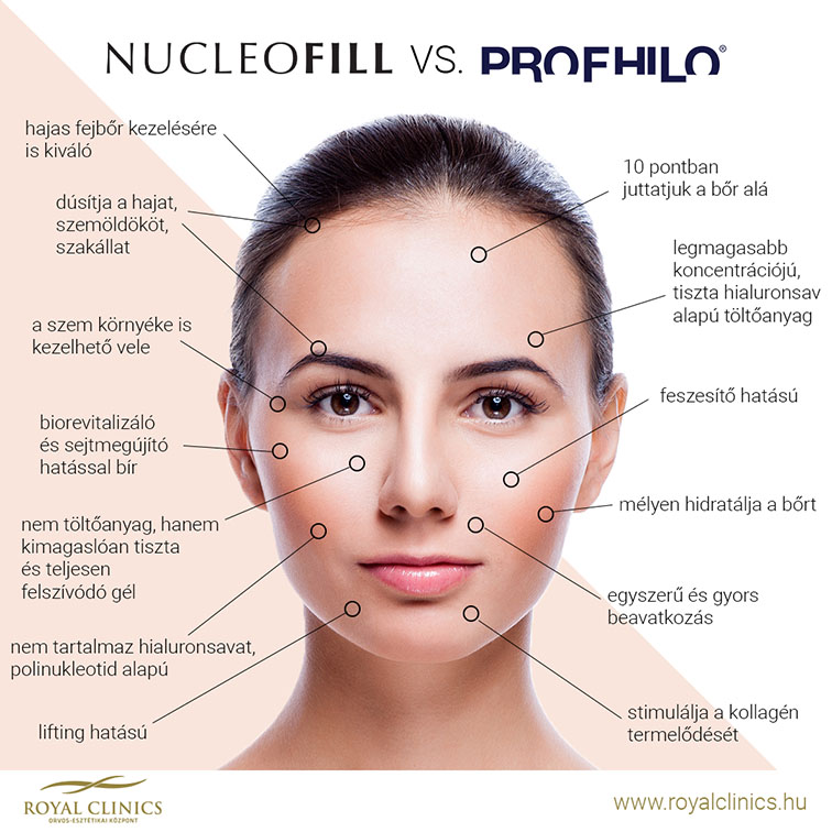 nucleofill vagy profhilo összehasonlítás