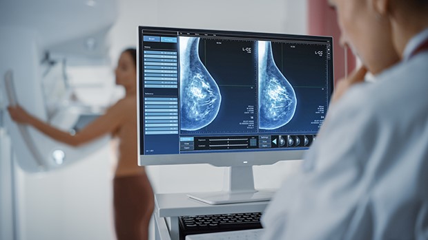 Mammográfiás röntgen felvétel