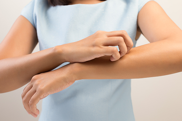 arometerápia homeopátia gél csípésre