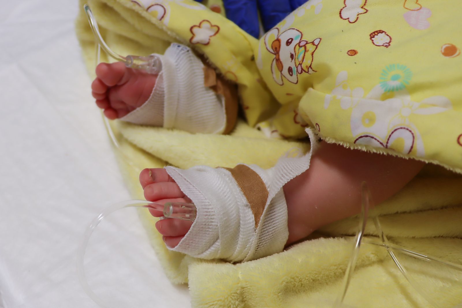 sma szűrés újszülött génterápia