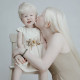 Mivel nincs más albínó a családban, nagyon meglepődtek rajta. Főleg, hogy az első gyermek, aki egy fiú, nem így született.