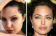 Angelina Jolie orra is műtéti úton szépült meg (ajkán, és szemöldöke ívén is így csinosítgattak)