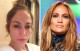Jennifer Lopez külsején állandóan csak ámulunk, azonban a smink mögött neki is vannak bőrproblémái, például durva pirossággal küzd. Az énekesnőt ez nem zavarja, bátran mutatja meg bőrét, annak minden hibájával együtt - és nagyon jól is teszi!