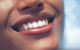 A fogak ásványi anyagokból épülnek fel, így ha sérülés éri például a zománcot, akkor a fogbélben található alvó őssejtek felélednek és gyógyításba kezdenek. Érdekes tény, hogy az őssejtek felszínén lévő receptorok jelenléte arra utal, hogy képesek reagálni a dopamin és a szerotonin jelenlétére is.