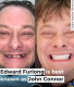 Ahogy ebből a videóból is kiderül, Furlong kábítószerfüggősége miatt elveszítette a fogait. Az elmúlt években azonban új fogsort csináltatott magának, és óriási erőfeszítéseket tett annak érdekében, hogy kimásszon a gödörből.