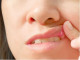Sebek a szájüregben

A száj belsejében lévő fájdalmas sebek kialakulhatnak hormonális változások vagy érzelmi stressz hatására. A B-12 vitaminhiány egy jellemző ok, ami miatt a sebek megjelenhetnek.
