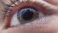 Ha olyan nagy mennyiségben van a szemünkben, amely már zavarja a hétköznapjainkat, akkor a szemész javasolhat lézeres eltávolítást, illetve szemészeti műtétet is.&nbsp;

