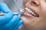 Ajánlott legalább félévente fogtisztító kezelésre, minimum évente pedig fogászati kontrollvizsgálatra menned.