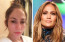 Jennifer Lopez külsején állandóan csak ámulunk, azonban a smink mögött neki is vannak bőrpoblémái, például durva pirossággal küzd. Az énekesnőt ez nem zavarja, bátran mutatja meg bőrét, annak minden hibájával együtt.
