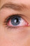 Bár kevesen tudják, életkorunk előrehaladtával bizony szemünk bizonyos részeinek színe is megváltozhat.&nbsp;A szklera és a kötőhártya (a vékony, átlátszó hártya, amely védi a szklerát) is szürkévé vagy sárgává válhat UV-károsodás miatt (bár a dohányzás is okozhatja a szemek elszíneződését). Leggyakrabban viszont mégis a szemszárazság említhető,&nbsp;amely vörös, viszkető és fáradt szemeket eredményez, amely vörös, viszkető és fáradt szemeket eredményez, egyes kutatások szerint ez a probléma ugyanis&nbsp;6 millió embert érint csak az Egyesült Államokban.
