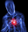 A szívroham nem mindig jelentkezik klasszikus tünetekkel, mint a mellkasi fájdalom, vagy a légszomj. Akadnak esetek, amikor a beteg azonnal elájul.
